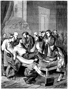 First surgical operation with sulfuric ether anesthesia at Boston Hospital, performed on October 16