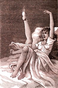 Hysteria, an extremely mental phenomenon, psychoses and psychoneurosis. 1887 by French School