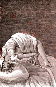 Hysteria, Mental and Nervous Disorder, Arising from Intense Anxiety. 1887 by French School