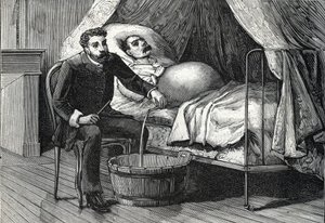 Patient with advanced liver cirrhosis, doctor performing a puncture (engraving, 1888) by French School