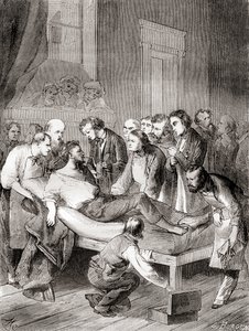The First Public Demonstration of the Use of Inhaled Ether as a Surgical Anaesthetic in 1846 by William Thomas Green Morton