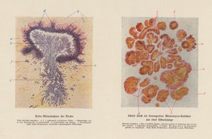 Actinomyces bovis by German School