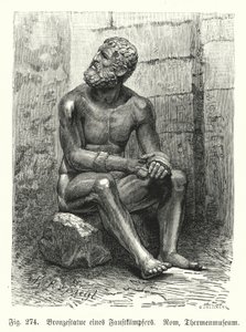 Ancient Greek or Roman Bronze Statue of a Seated Boxer by German School