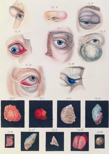 Description of congenital eye anomalies, from Klinische Darstellungen der Krankheiten und Blidungsfehler des Menschlichen Auges, by Friedrich August von Ammon, 1838 by German School