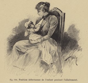 Incorrect Position of a Baby During Breastfeeding by German School