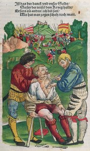 Removing an Arrow, Illustration from Feldtbuch der Wundartzney by Hans von Gersdorff