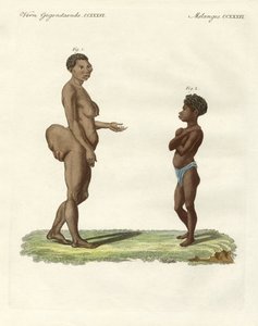 Strange human varieties