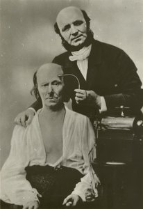French neurologist Duchenne de Boulogne using his electrophysiology apparatus on an old man by Guillaume Benjamin Armand Duchenne de Boulogne