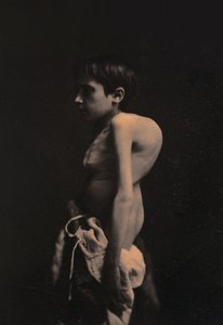 Portrait of a hunchback boy