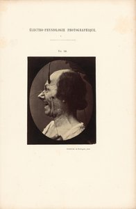 Electro-Physiology Photographic, Figure 39 by Guillaume Benjamin Duchenne