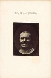 Electro-Physiological Photography, Figure 53 by Guillaume Benjamin Duchenne