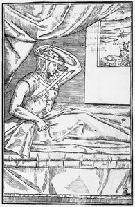 Reconstructive surgery on the nose, illustration from De curtorum chirurgia per insitionem by Gaspare Tagliacozzi, Venice, published 1597