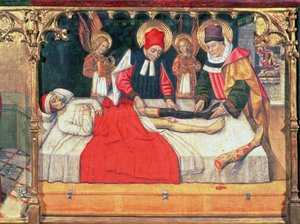 SS. Cosmas and Damian Graft the Leg of an Ethiopian Man onto the Stump of Deacon Justinian by Jaume Huguet