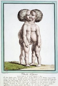 Siamese Children - in 