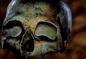 Skull of a girl, Mas-d