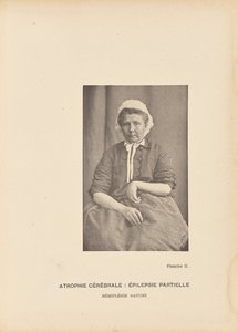 Cerebral Atrophy: Partial Epilepsy Left Hemiplegia by Paul Marie Léon Regnard