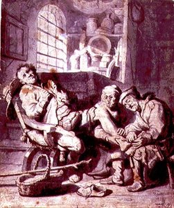 The Sprained Foot by Rembrandt Harmensz. van Rijn