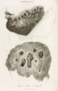 Skin Diseases by John Pardon
