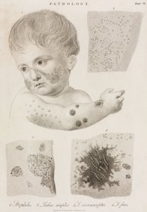 Types of Skin Disease by John Pardon