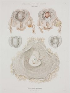 Human Uterus with Embryo, c 1847-1859