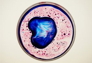 Petri Dish by Steve Pavlovsky