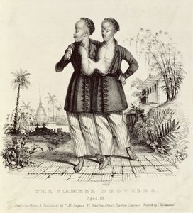 The Siamese Brothers, Aged 18, printed by Charles Hullmandel