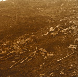 After the Attack, Les Éparges, Northern France, 1915 by Unbekannt