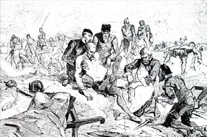 Ambroise Pare tying off arteries after amputation