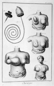 Breast Surgery