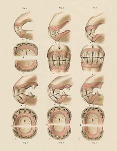 Description of Plate Showing the Age, as Indicated by the Teeth by Unbekannt