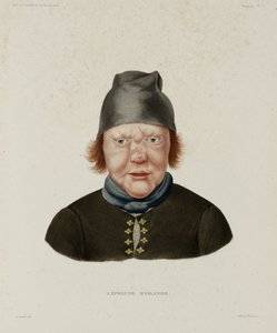 Diseases, Leprosy Female Leper, Iceland, early 19th century by Unbekannt