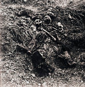 Human Remains