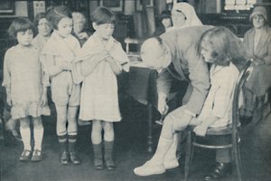 Testing the Patella Reflex for Indication of Nervous Disease by Unbekannt