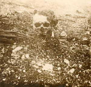 The Crown Prince, Verdun, Northern France