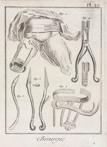 Early-Modern Orthopaedic surgery
