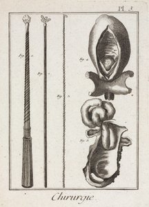Early-Modern Surgical Instruments and Diagrams of Body Parts