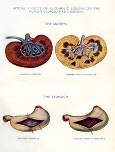 Kidneys and stomach affected by alcohol