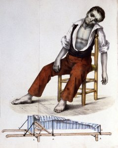 Patient with Cholera