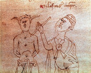 A Patient Consulting a Miniature Doctor from the Manuscript De Surgia
