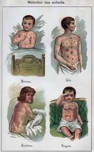 Diseases of children: Hives, Measles, scabies, scarlet fever. In 