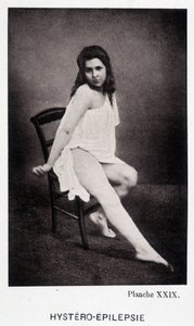 Hystero Epilepsie - Contracture in “Photographic iconography of the Salpêtrière: service of Mr. Charcot” by Paul Regnard and Bourneville by Unknown artist