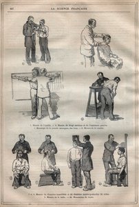 Judicial Anthropometry or Bertillonage, Method of Alphonse Bertillon - Engraving in 