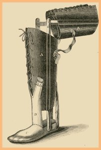 Leg Replacement