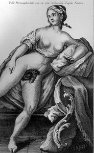Hermaphrodite Girl Seen in 1751 and Drawn from Nature by Unknown artist