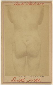 Jno. E. Tucker, Shot in the Buttocks, Civil War Victim by Unknown artist