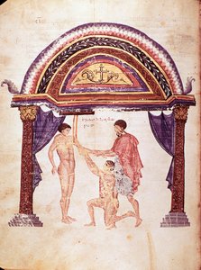 Medicine: Reduction of a Dislocated Elbow, Patient is Hanged by the Arm by Unknown artist