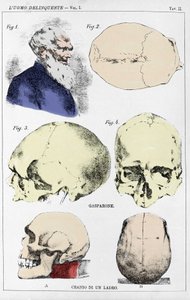 Study on the morphology of a delinquent skull by the Italian criminologist by Unknown artist