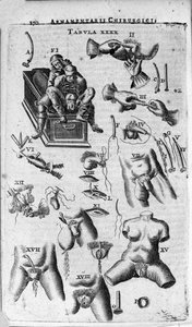 Surgical Interventions on the Female and Male Sexes by Unknown artist