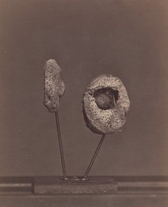 Excised Knee Joint. A Round Musket Ball in the Inner Condyle of the Right Femur by William H. Bell
