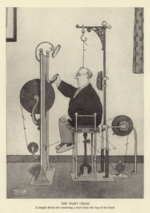 The wart chair, a simple device for removing a wart from the top of the head